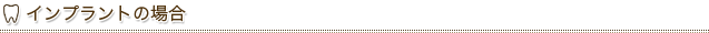 インプラントの場合