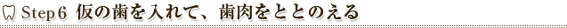 Step6 仮の歯を入れて、歯肉をととのえる