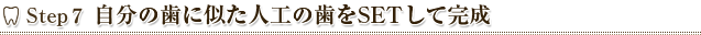 Step7 自分の歯に似せた人工の歯をSETして完成