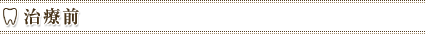 治療前