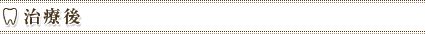 治療後